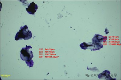 交聯(lián)透明質(zhì)酸鈉凝膠顆粒剖析內(nèi)在價值的顯微分析方案 